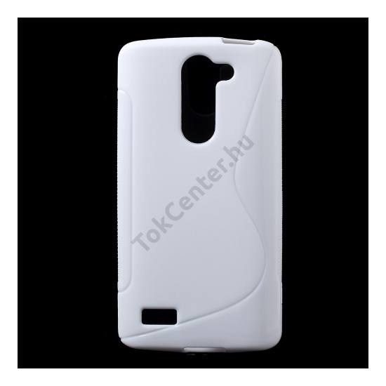 LG L80+ L Bello (D331)  Telefonvédő gumi / szilikon (S-line) FEHÉR