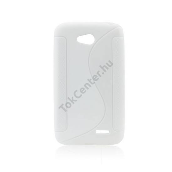 LG L65 (D280) Telefonvédő gumi / szilikon (S-line) FEHÉR