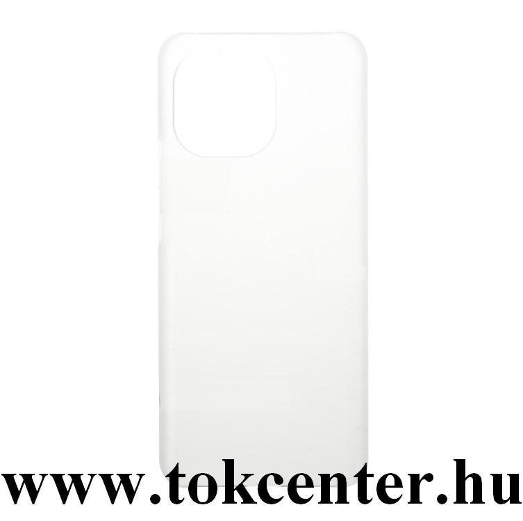 Xiaomi Mi 11 Műanyag telefonvédő (gumírozott) ÁTLÁTSZÓ