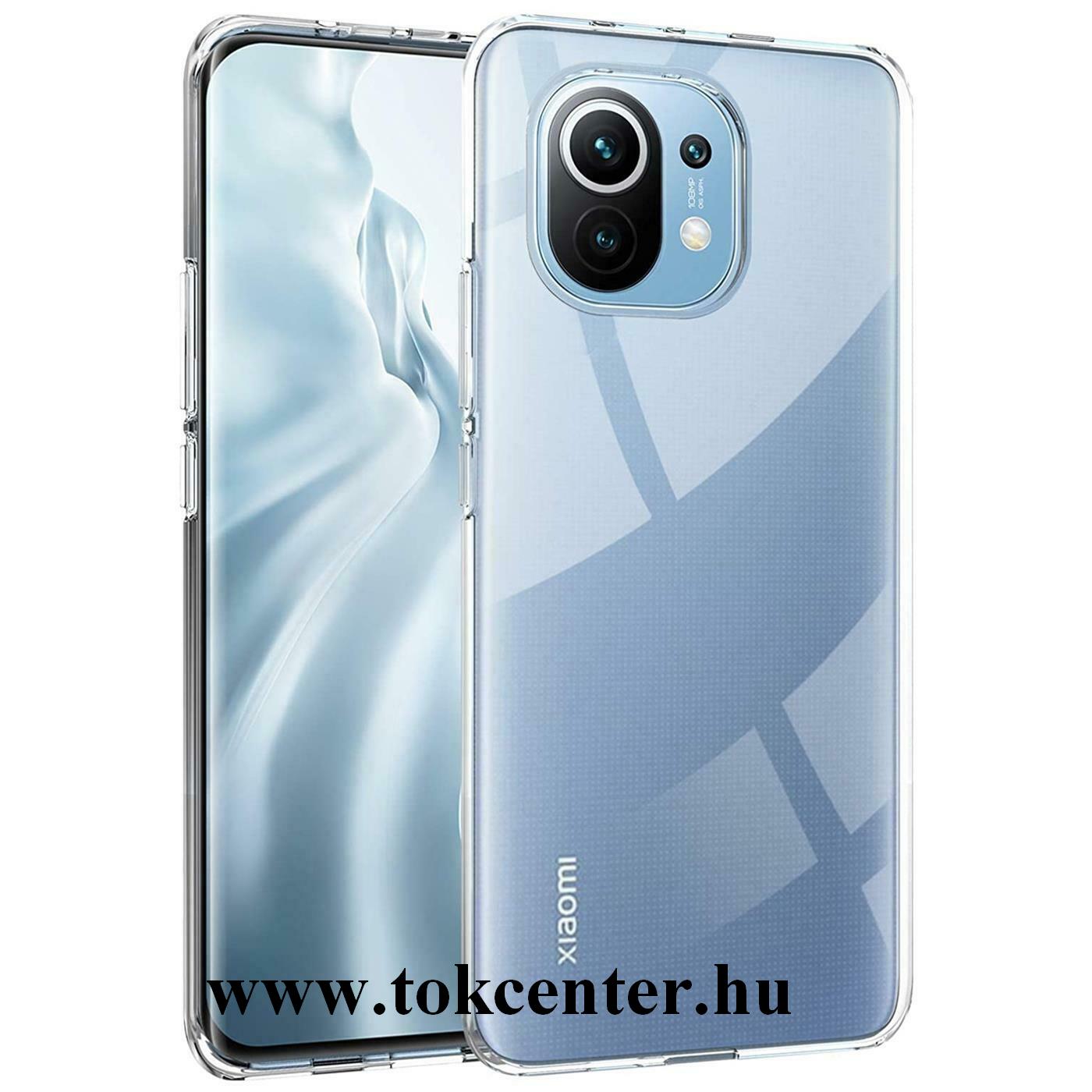 Xiaomi Mi 11 Szilikon telefonvédő (ultravékony) ÁTLÁTSZÓ