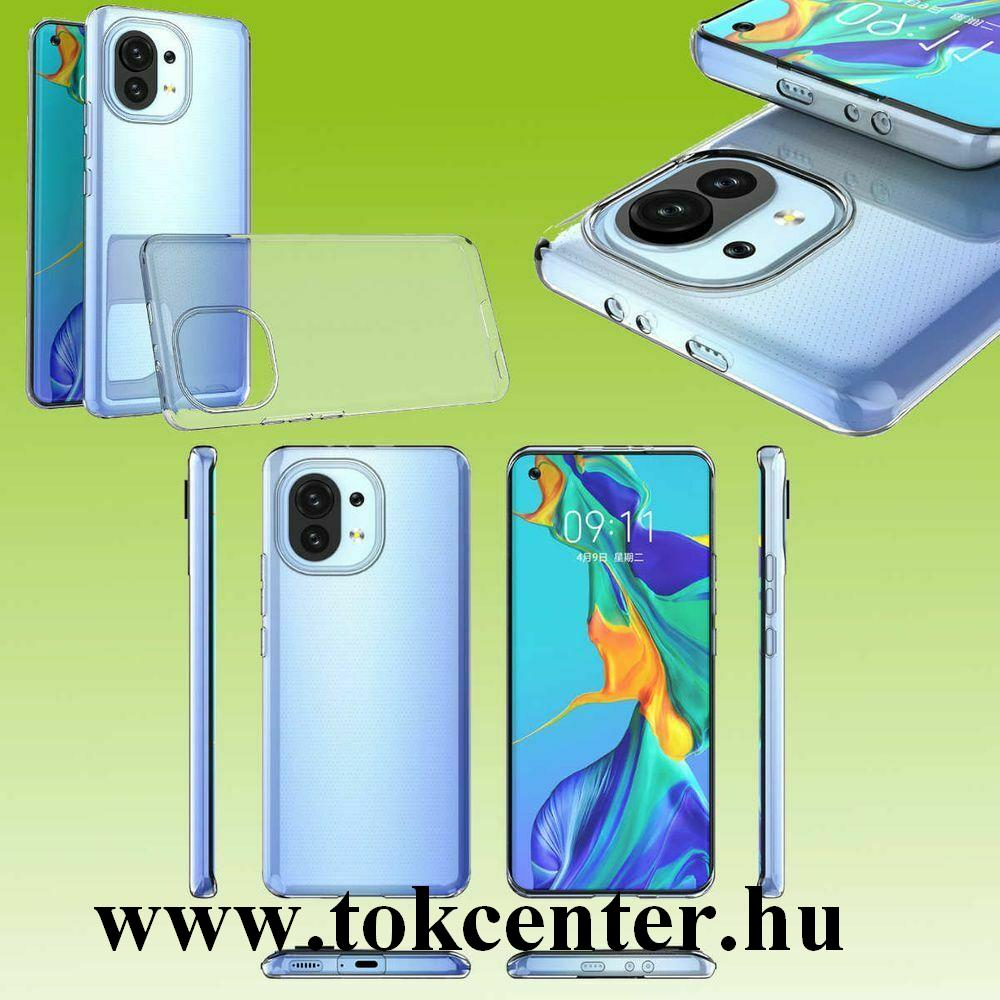Xiaomi Mi 11 Lite Szilikon telefonvédő (ultravékony) ÁTLÁTSZÓ