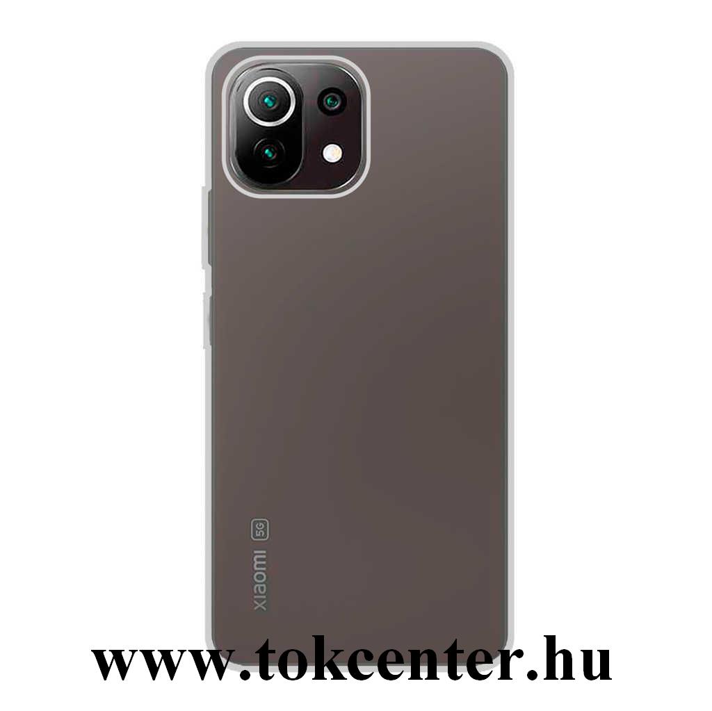 Xiaomi Mi 11 Lite 5G Szilikon telefonvédő (ultravékony) ÁTLÁTSZÓ